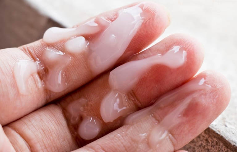Tinh trùng đặc hay loãng đều là triệu chứng cảnh báo của nhiều vấn đề, bệnh lý tiềm ẩn