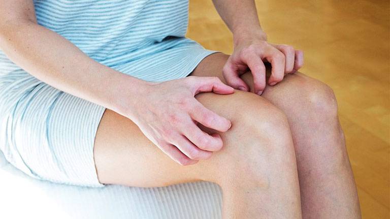 Viêm da tiếp xúc bao lâu thì khỏi? Làm sao nhanh khỏi?