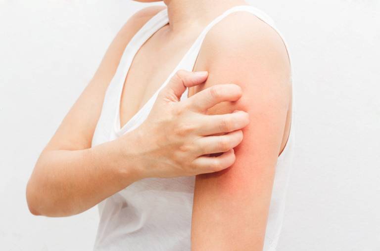Nguyên tắc chọn xà phòng tắm cho người bị viêm da cơ địa