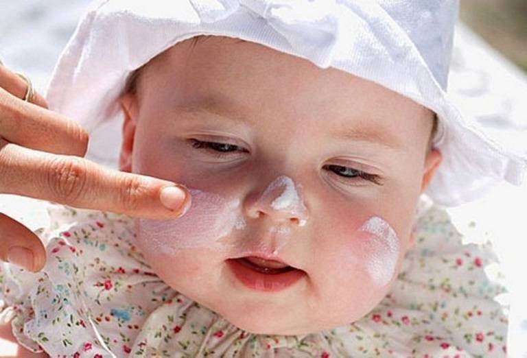 Bé bị chàm sữa bôi thuốc gì an toàn và không tác dụng phụ?