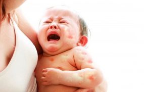 Dị ứng sữa mẹ là gì?