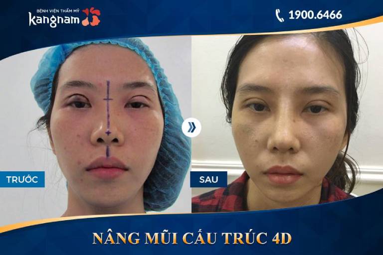 Bệnh viện thẩm mỹ Kangnam