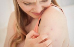 Da bị đỏ mẩn ngứa tróc vẩy là bệnh gì? Nguy hiểm không?