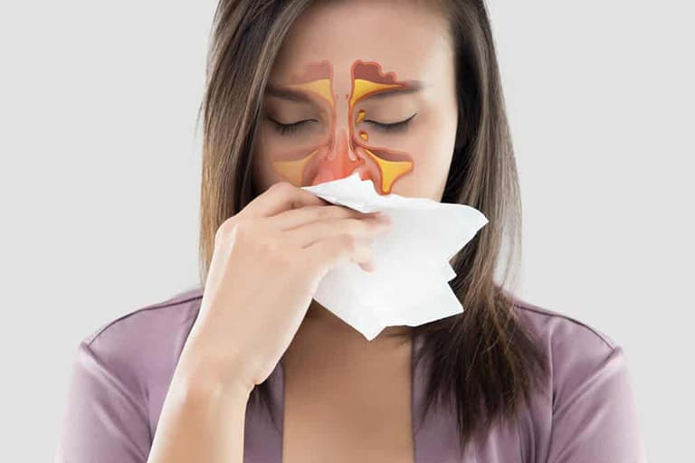 Đau họng nhức đầu mệt mỏi