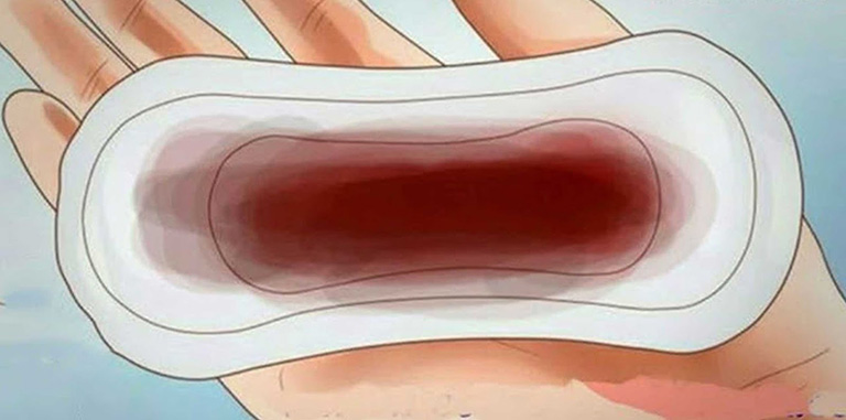12 nguyên nhân khiến mẹ bầu ra dịch nâu khi mang thai
