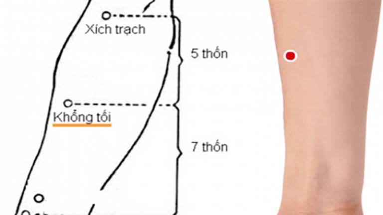 Bấm huyệt Khổng tối cải thiện bệnh viêm amidan