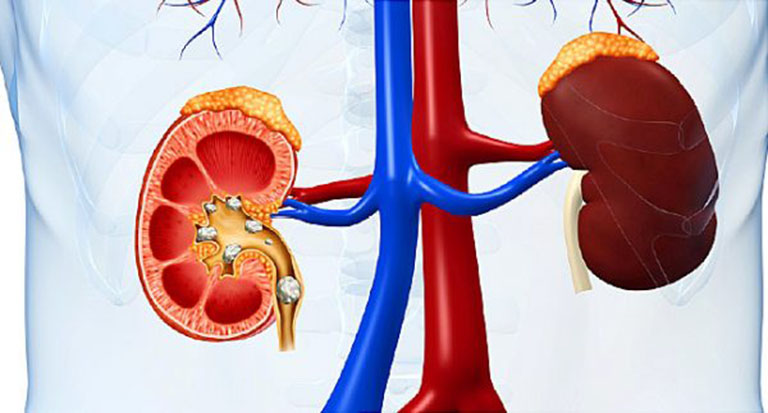 đau thượng vị bên trái