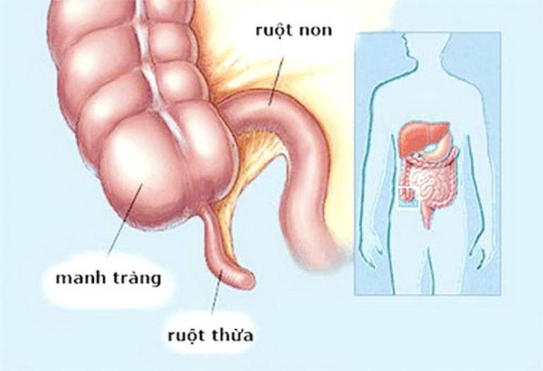 đau thượng vị bên trái