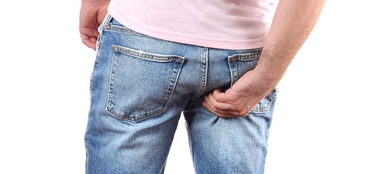 Hắc lào ở mông: Thuốc trị và phòng ngừa bệnh tái phát