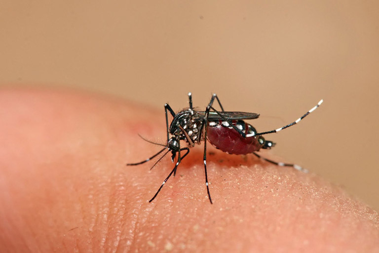 Sốt xuất huyết Dengue ở trẻ em