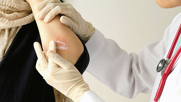 10+ Thuốc trị nấm da tốt nhất giúp điều trị bệnh nhanh chóng
