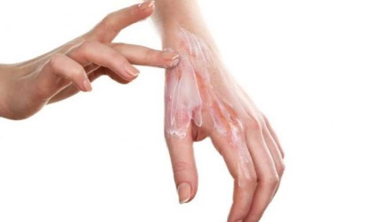 Một số lưu ý khi sử dụng thuốc trị nấm da