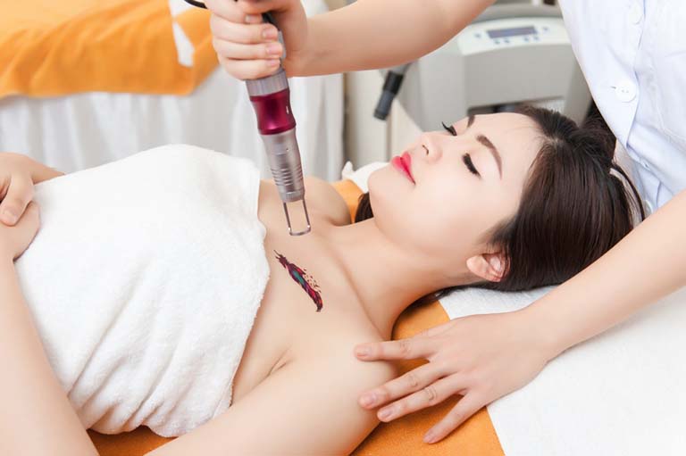 Top 10 địa chỉ xóa xăm bằng laser uy tín không đau tại TPHCM
