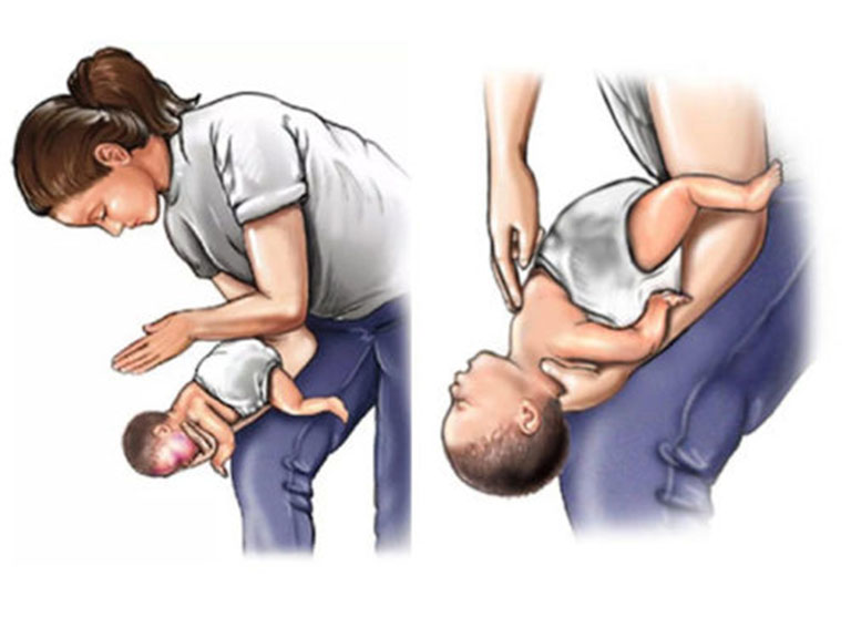 trẻ sơ sinh 1 tháng tuổi bị ho