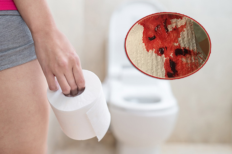 Đau dạ dày đi ngoài ra máu