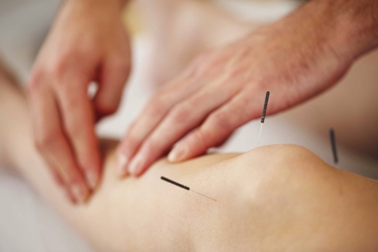 thoái hóa khớp gối