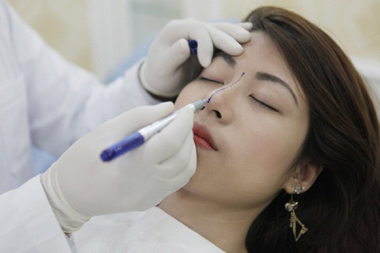 biến chứng sau khi nâng mũi