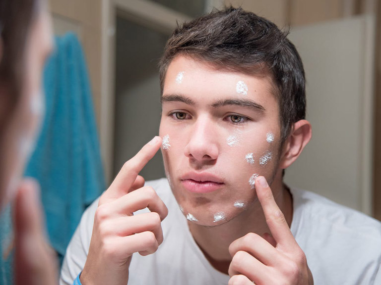 cách trị mụn bằng kem đánh răng có tốt không