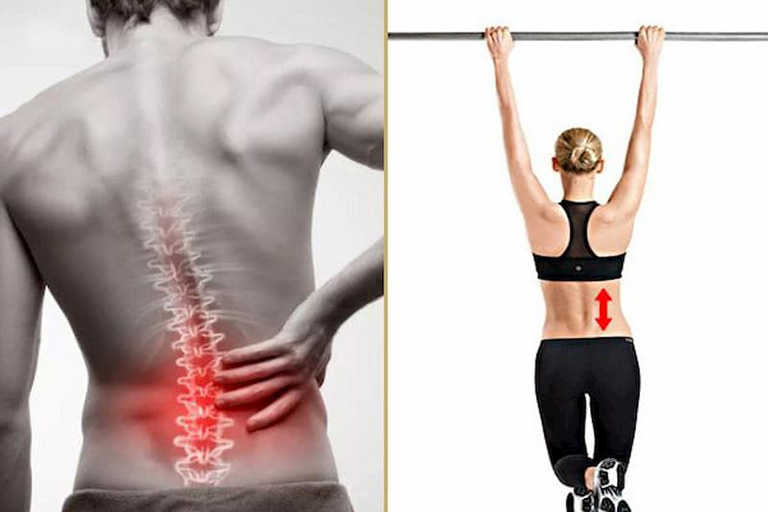 Chữa thoát vị đĩa đệm bằng xà đơn an toàn không?