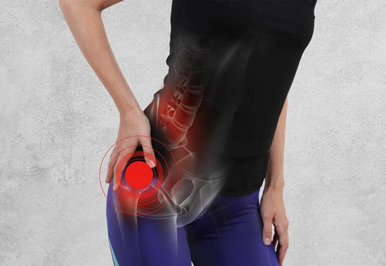 Đau thần kinh tọa là gì? Nguyên nhân, Triệu chứng, Cách điều trị