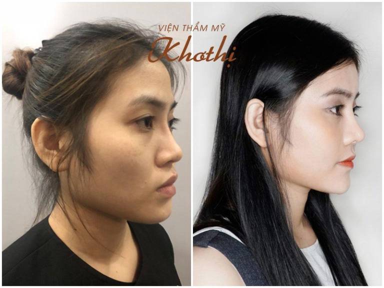 Viện thẩm mỹ Khơ Thị