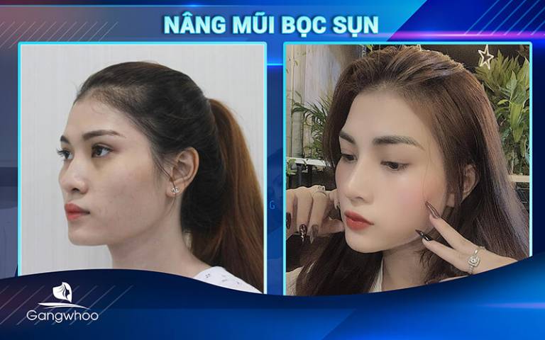 Thẩm mỹ viện Hàn Quốc Gangwhoo
