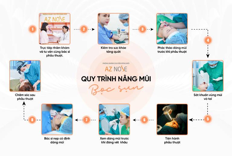 Thẩm mỹ AZ NOSE - Chuyên sâu nâng mũi