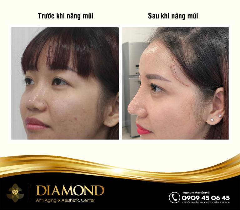 Thẩm Mỹ Công Nghệ Cao Diamond