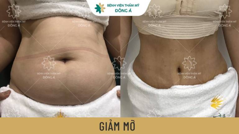 Bệnh viện thẩm mỹ Đông Á