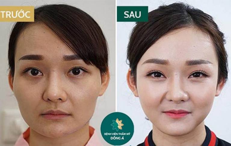 Thẩm mỹ viện Đông Á