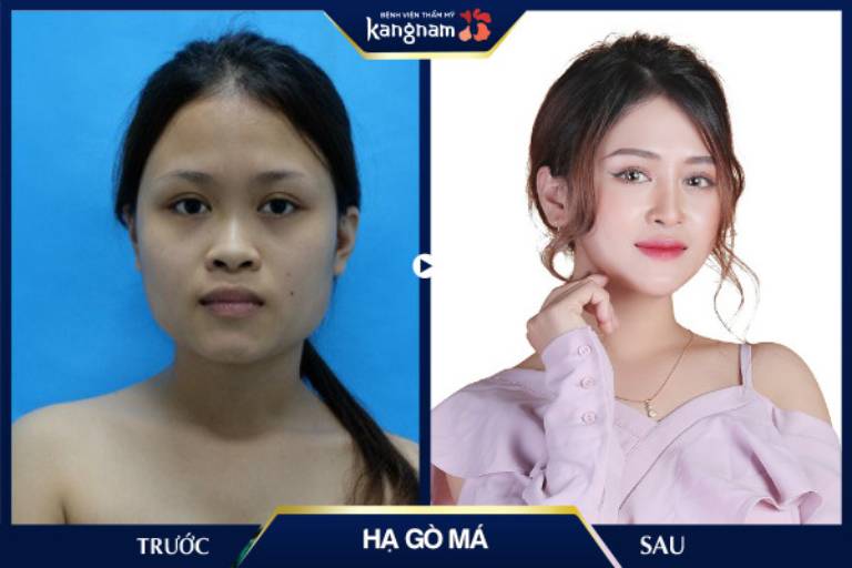 Bệnh viện thẩm mỹ Kangnam
