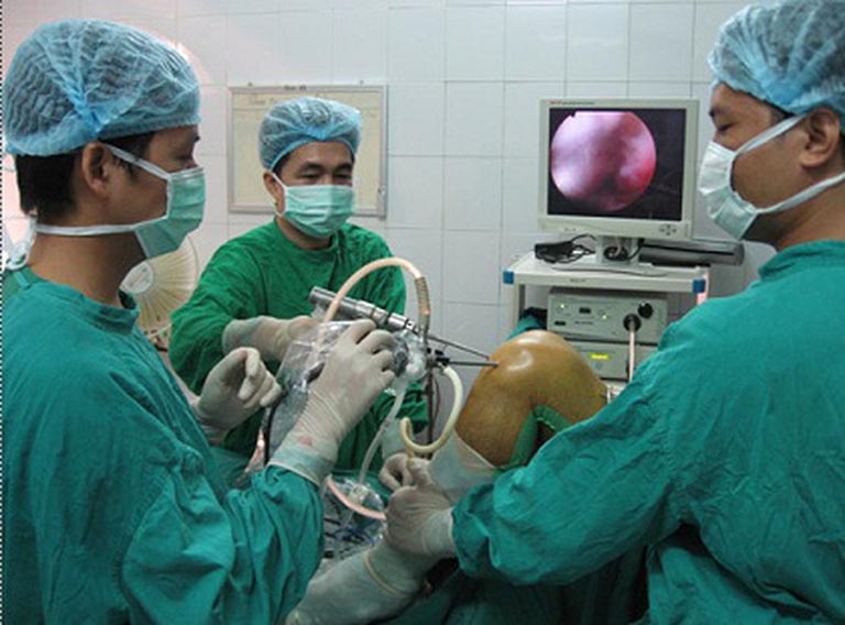 Rách sụn chêm khớp gối