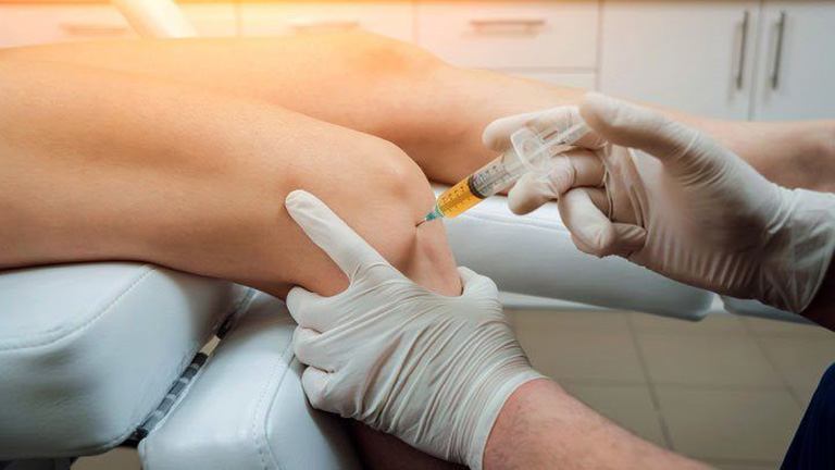 Rách sụn chêm khớp gối