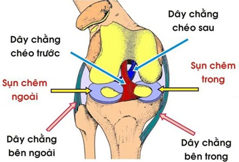 Rách sụn chêm khớp gối