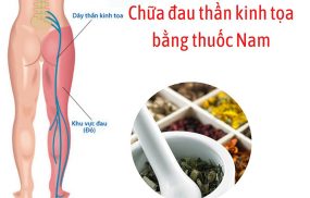 thuốc nam chữa đau thần kinh tọa