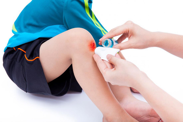 Tràn dịch khớp gối ở trẻ em