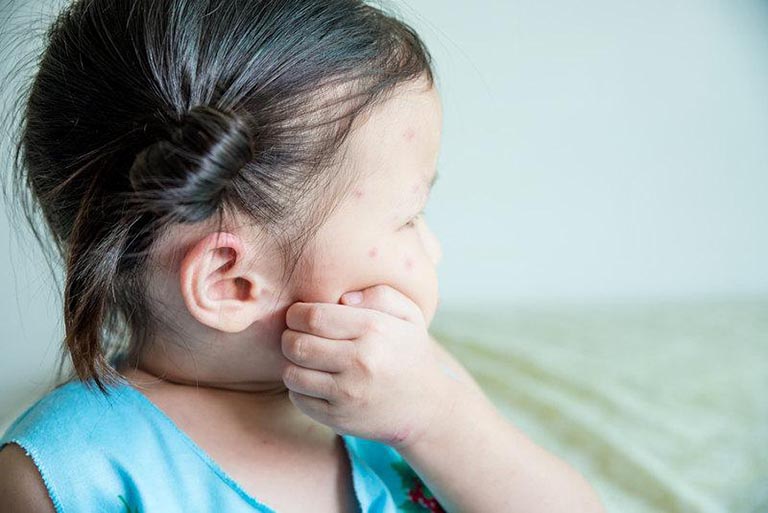Chăm sóc người bệnh sốt xuất huyết