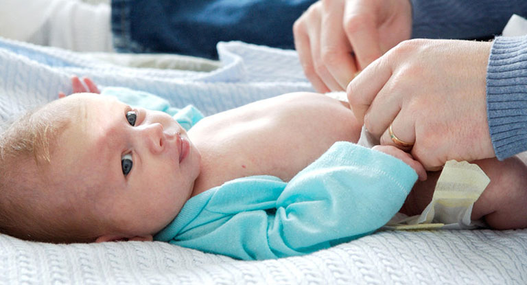 Cách chăm sóc rốn cho trẻ sơ sinh mẹ cần biết