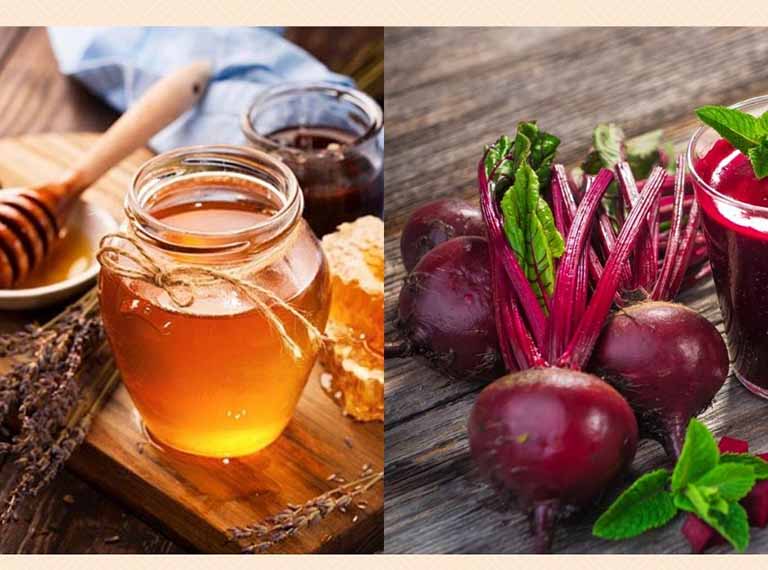 Chữa bệnh trĩ bằng mật ong