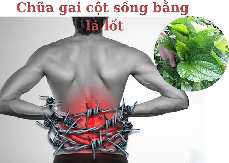 chữa gai cột sống bằng lá lốt