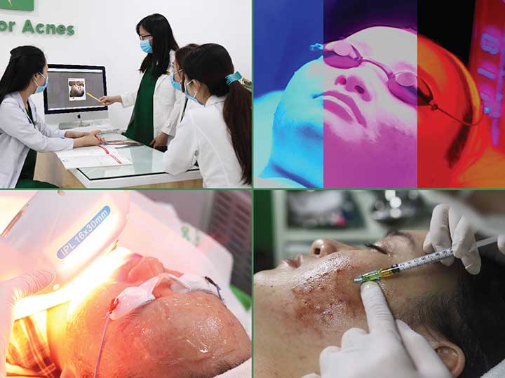 Điều trị mụn tại pk da liễu doctor acnes 