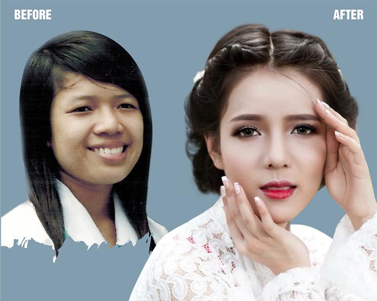 các dáng mũi đẹp