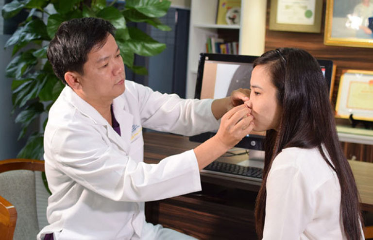 Nâng mũi 2 tháng vẫn sưng