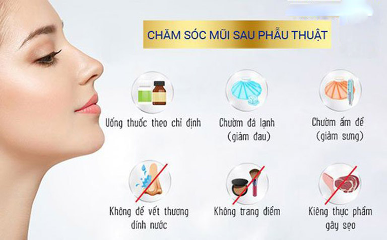 Sau nâng mũi mấy ngày tháo băng?