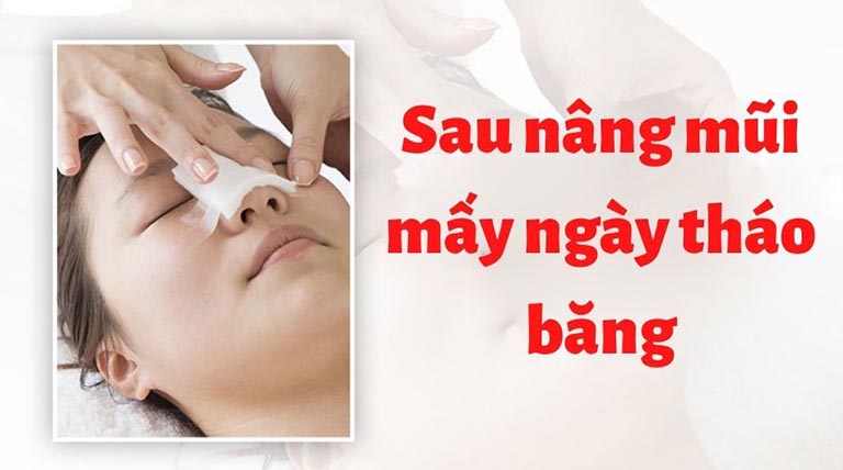 Sau nâng mũi mấy ngày tháo băng?