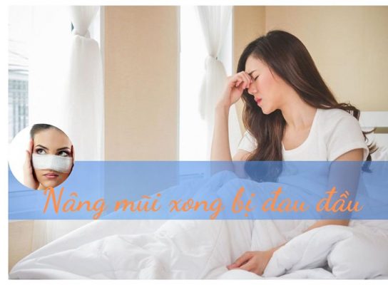 Nâng mũi xong bị đau đầu