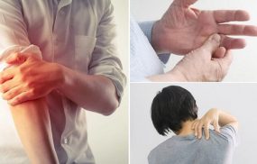 Thoái hóa đốt sống cổ gây tê tay
