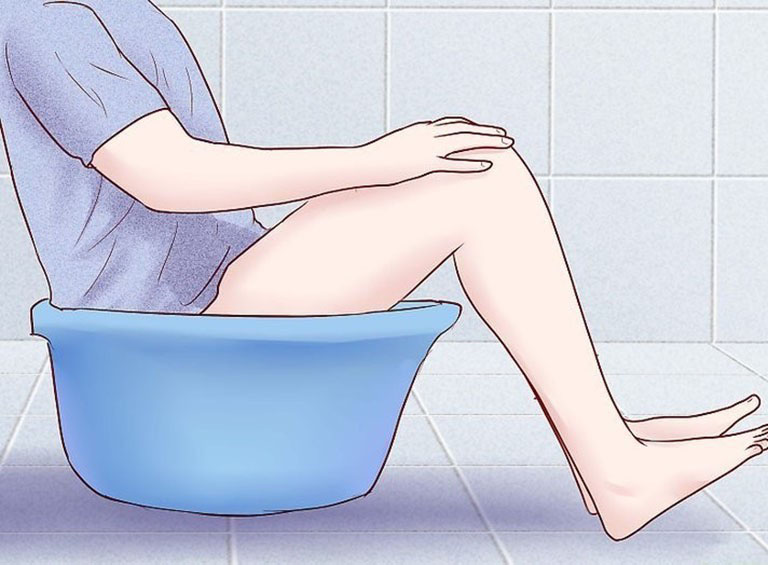 thắt búi trĩ bằng vòng cao su