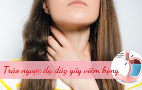 Trào ngược dạ dày gây viêm họng