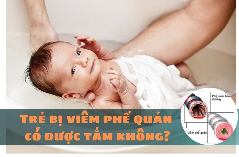 Trẻ bị viêm phế quản có được tắm không